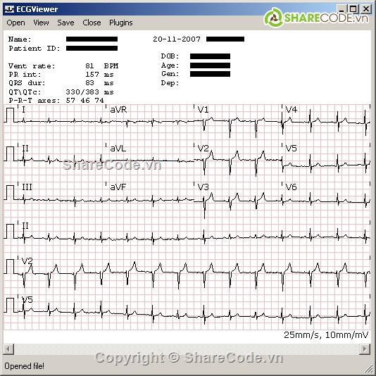 ECG,điện tâm đồ,C#